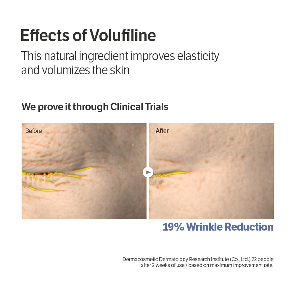 Plump, Bouncy & Glass-Like Skin